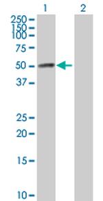 HAVCR1 Polyclonal Antibody, MaxPab™
