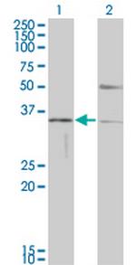 HAVCR1 Monoclonal Antibody (1E5)