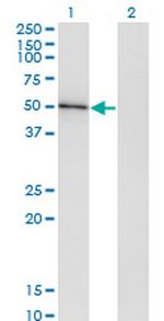 HAVCR1 Monoclonal Antibody (2G11)