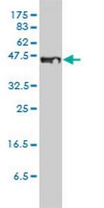 STEAP1 Monoclonal Antibody (4F6-1F3)
