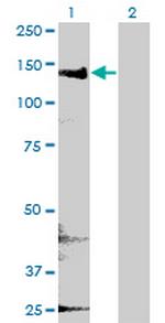 CYFIP2 Antibody in Western Blot (WB)