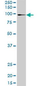 ATP2C1 Antibody in Western Blot (WB)