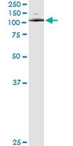 ATP2C1 Antibody in Immunoprecipitation (IP)