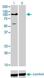 ATP2C1 Antibody in Western Blot (WB)