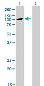 ATP2C1 Antibody in Western Blot (WB)