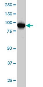 ATP2C1 Antibody in Western Blot (WB)