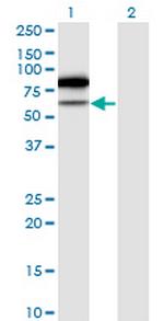 TRMT2A Monoclonal Antibody (4C10-1A11)