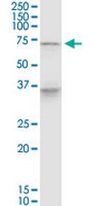 PELP1 Antibody in Western Blot (WB)