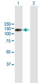 SND1 Polyclonal Antibody, MaxPab™