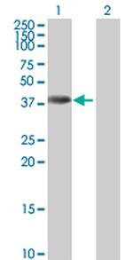 ANKRD1 Polyclonal Antibody, MaxPab™