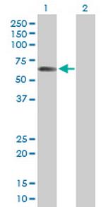STAU2 Antibody in Western Blot (WB)