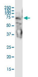 STAU2 Antibody in Western Blot (WB)