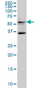 STAU2 Antibody in Western Blot (WB)