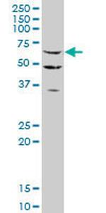 STAU2 Antibody in Western Blot (WB)