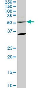 STAU2 Antibody in Western Blot (WB)