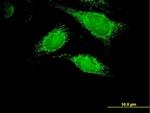 PPA2 Polyclonal Antibody, MaxPab™