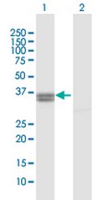 PPA2 Polyclonal Antibody, MaxPab™