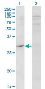 DAPP1 Monoclonal Antibody (1E1)