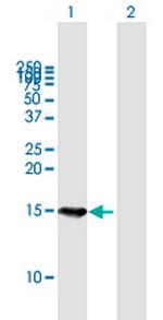 B9D1 Polyclonal Antibody, MaxPab™