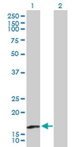 TRAPPC3 Antibody in Western Blot (WB)