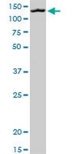 MORC1 Monoclonal Antibody (3E8)