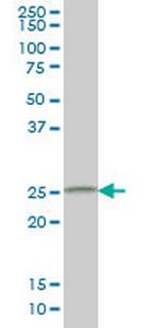 CIDEB Monoclonal Antibody (2A10)