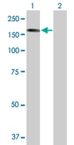 STK36 Antibody in Western Blot (WB)