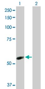 NDOR1 Antibody in Western Blot (WB)