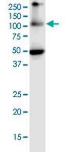 EIF2C2 Monoclonal Antibody (2E12-1C9)