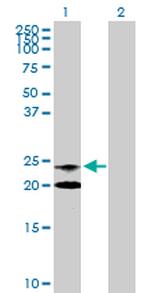 NAAA Antibody in Western Blot (WB)