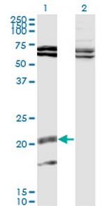 IL17B Monoclonal Antibody (1G6)