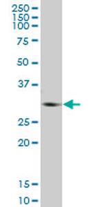 GNMT Antibody in Western Blot (WB)