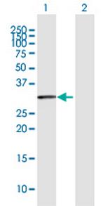 BBS9 Polyclonal Antibody, MaxPab™