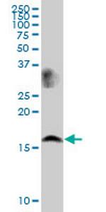LSM1 Polyclonal Antibody, MaxPab™