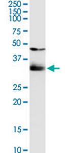 SULT1B1 Polyclonal Antibody, MaxPab™