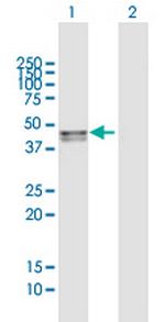 SMPDL3B Polyclonal Antibody, MaxPab™