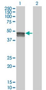 SMPDL3B Monoclonal Antibody (5E12)