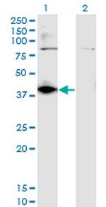 DHDH Antibody in Western Blot (WB)