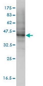 MOCS3 Monoclonal Antibody (1C5-E8)