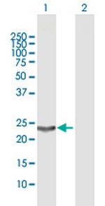 PGDS Polyclonal Antibody, MaxPab™