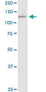 PCDH11X Monoclonal Antibody (7B4)