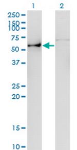 ANGPTL3 Monoclonal Antibody (3B7)