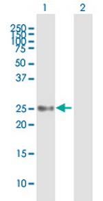 UBE2S Polyclonal Antibody, MaxPab™