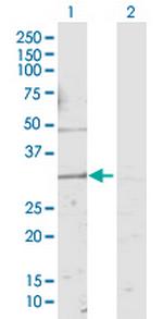 KCNMB4 Polyclonal Antibody, MaxPab™