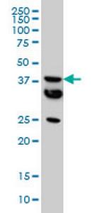 MT Monoclonal Antibody (2F2)