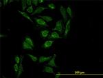 HTRA2 Monoclonal Antibody (6H8)