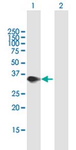PPP2R3B Polyclonal Antibody, MaxPab™