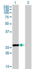 PPP2R3B Polyclonal Antibody, MaxPab™