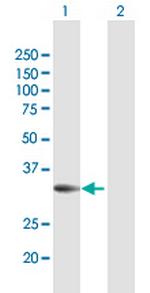 PPP2R3B Polyclonal Antibody, MaxPab™