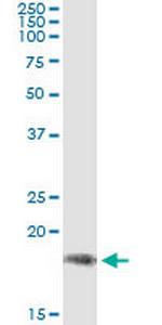 PPP2R3B Monoclonal Antibody (1F4)